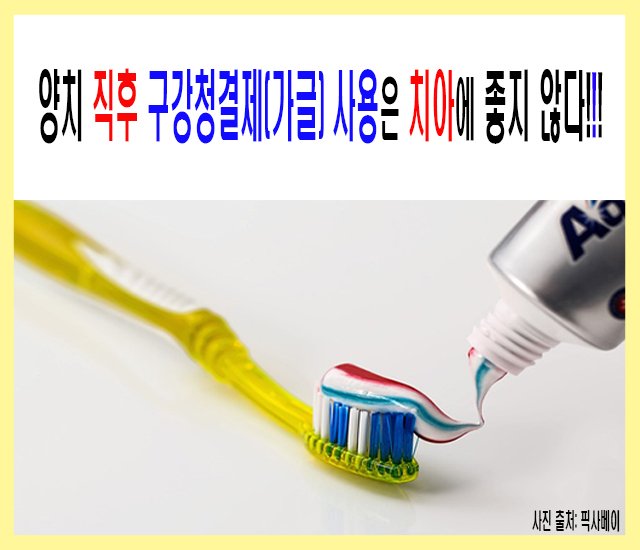 [치아 #1] 양치 직후 구강청결제(가글) 사용은 치아에 좋지 않다.jpg